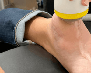 Softwave Therapy for Foot Injuries